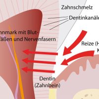 empfindliche_zaehne3_mittel